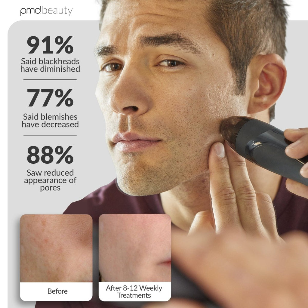 Sistema de cuidado de la piel en casa Personal Microderm Elite Pro