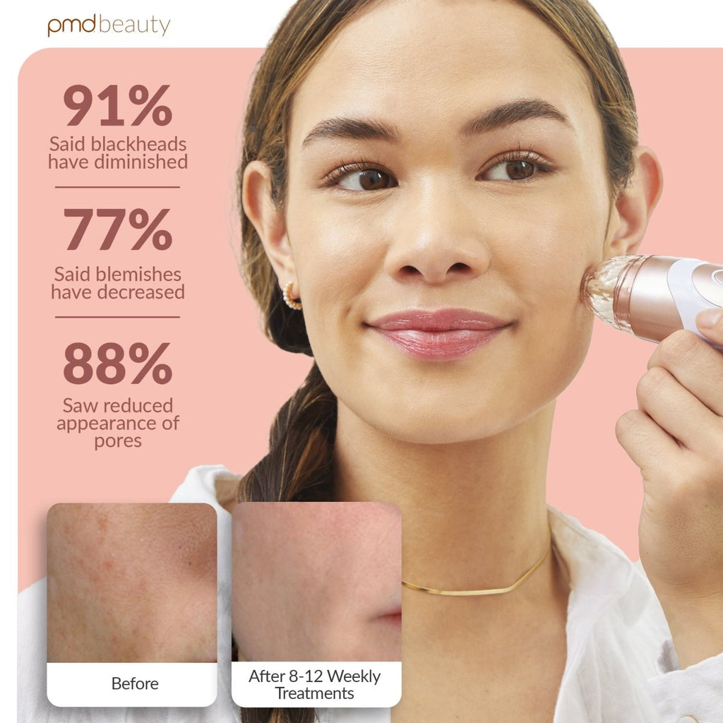 Sistema de cuidado de la piel en casa Personal Microderm Elite Pro