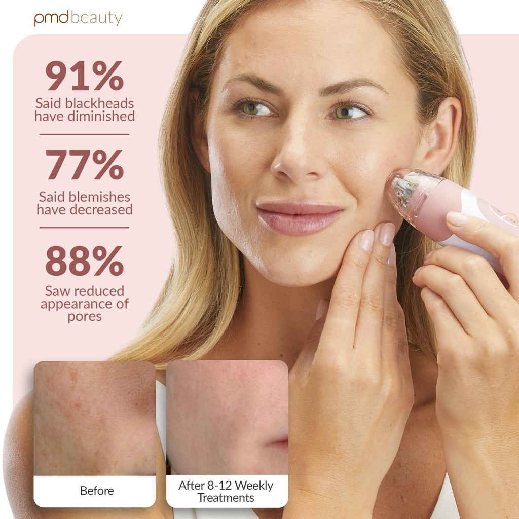 Sistema de cuidado de la piel en casa Personal Microderm Elite Pro