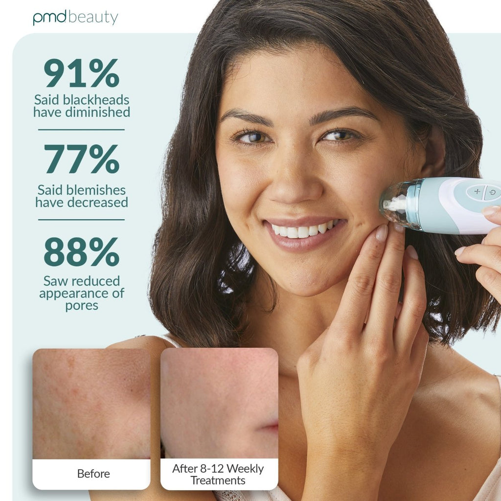 Sistema de cuidado de la piel en casa Personal Microderm Elite Pro