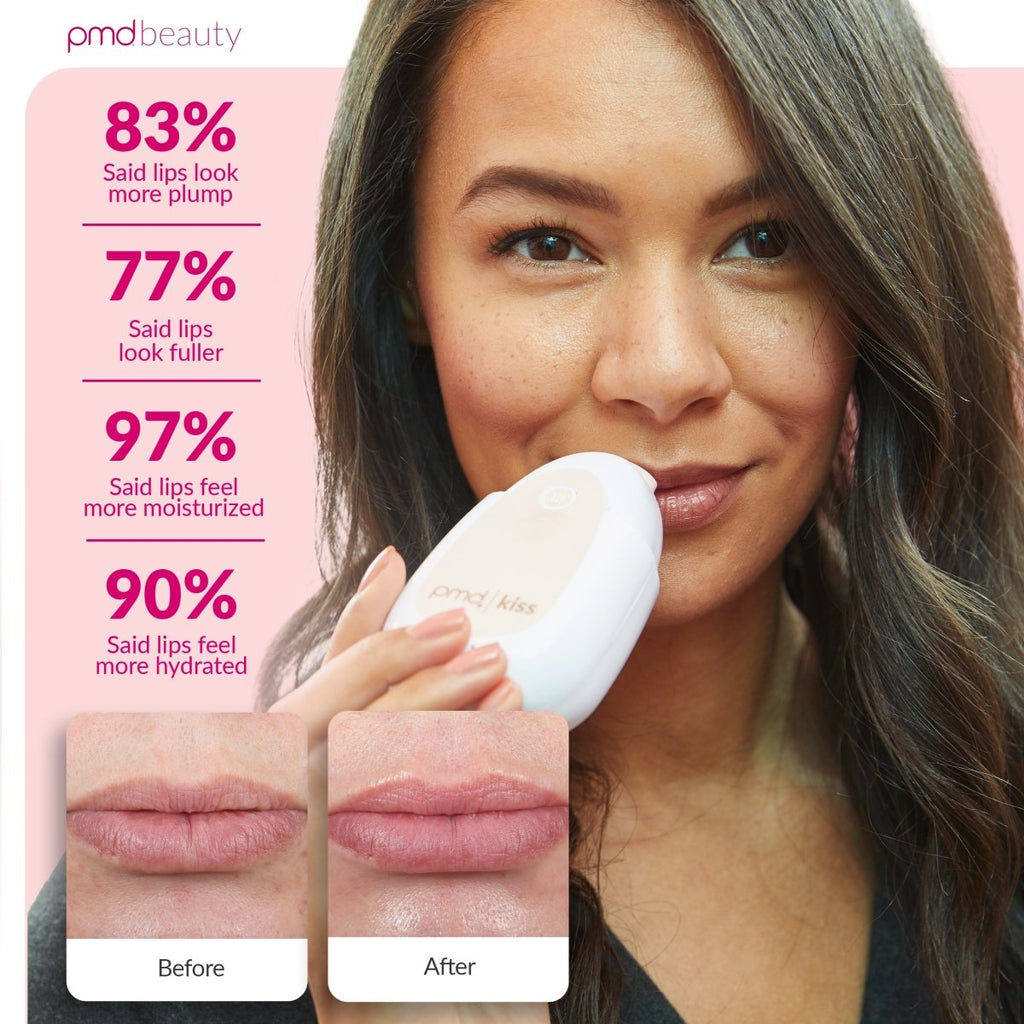 Sistema PMD Kiss – Kit de belleza profesional para usar en casa