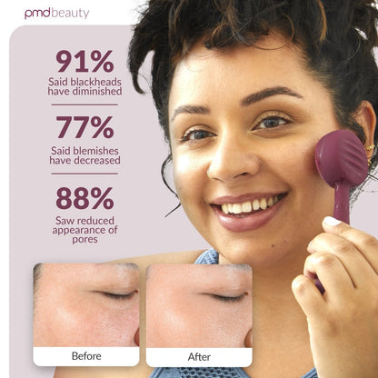 Diva - Dispositivo de limpieza facial PMD Clean