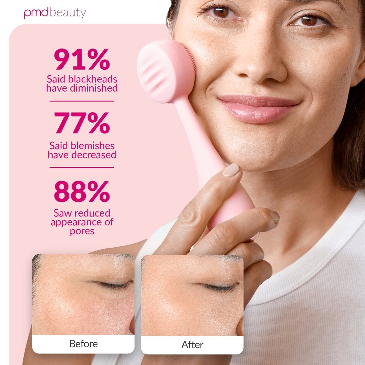 Diva - Dispositivo de limpieza facial PMD Clean