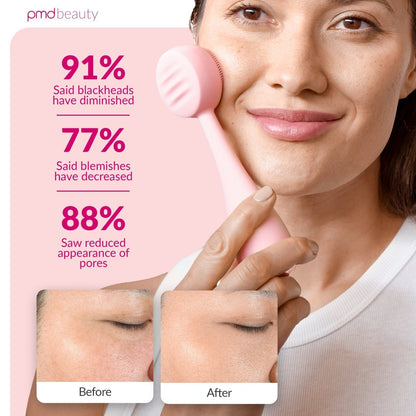 Diva - Dispositivo de limpieza facial PMD Clean