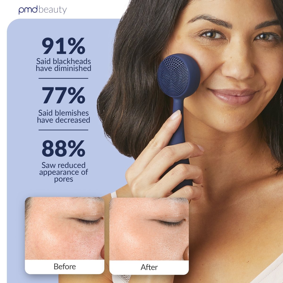 Diva - Dispositivo de limpieza facial PMD Clean