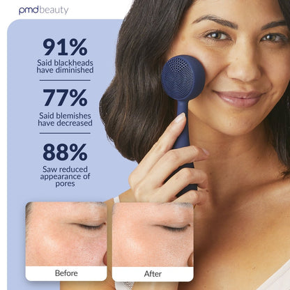 Diva - Dispositivo de limpieza facial PMD Clean
