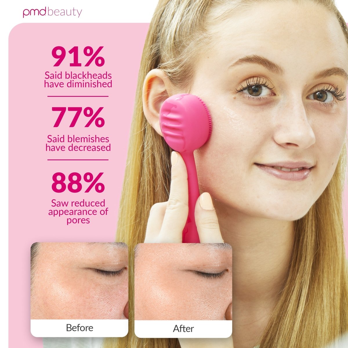 Diva - Dispositivo de limpieza facial PMD Clean