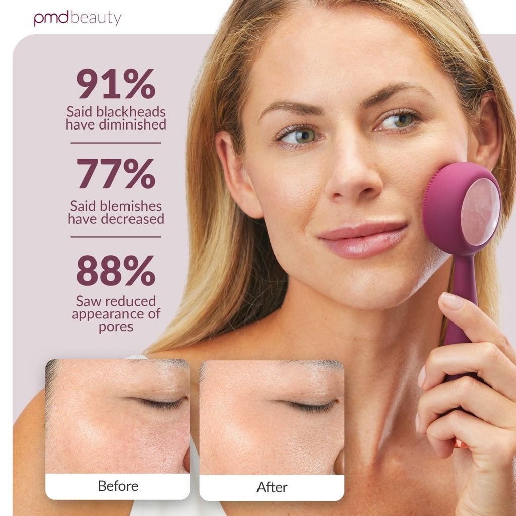 Dispositivo de limpieza facial PMD Clean Pro RQ