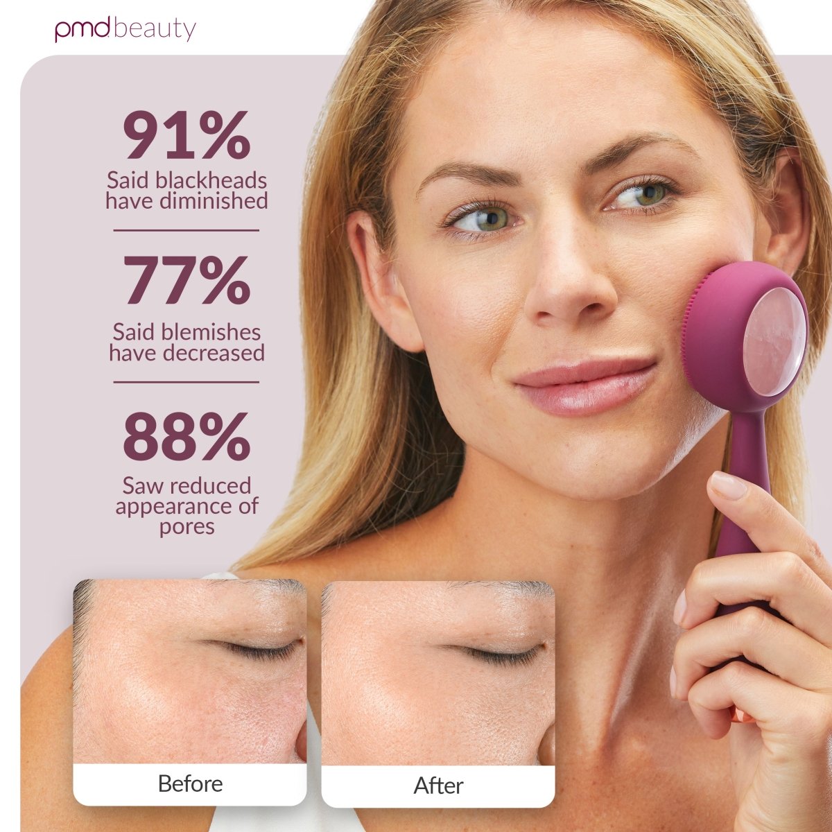 Dispositivo de limpieza facial PMD Clean Pro RQ