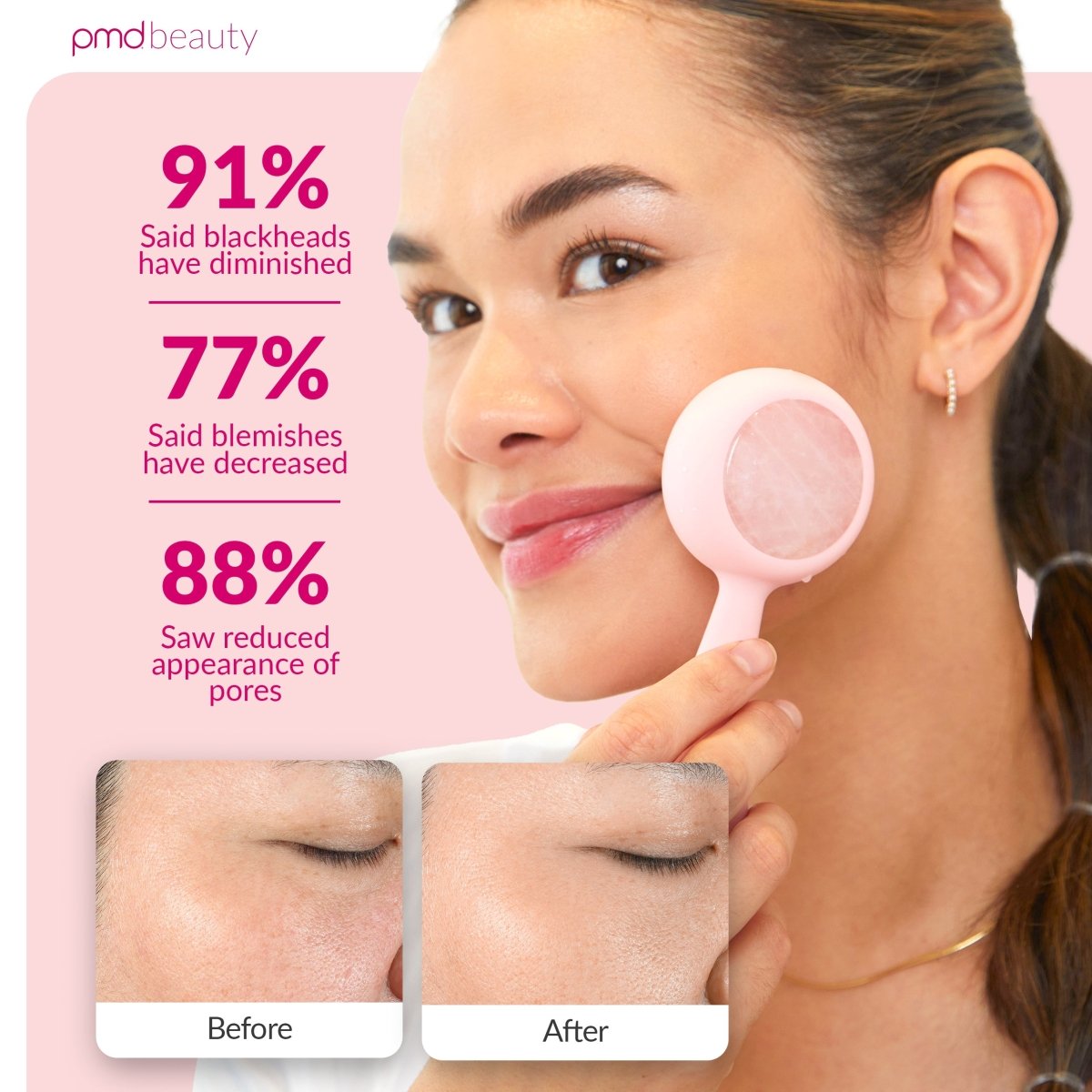 Dispositivo de limpieza facial PMD Clean Pro RQ
