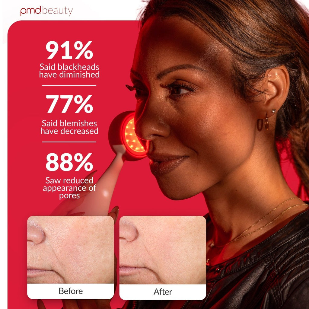 Dispositivo de tratamiento facial PMD LED Clean Redvolution