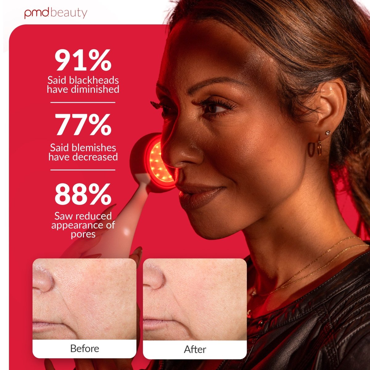 Dispositivo de tratamiento facial PMD LED Clean Redvolution