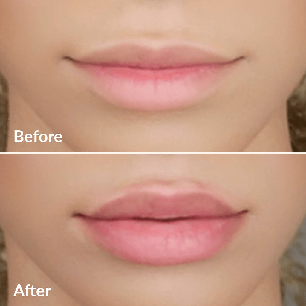 Sistema PMD Kiss – Kit de belleza profesional para usar en casa
