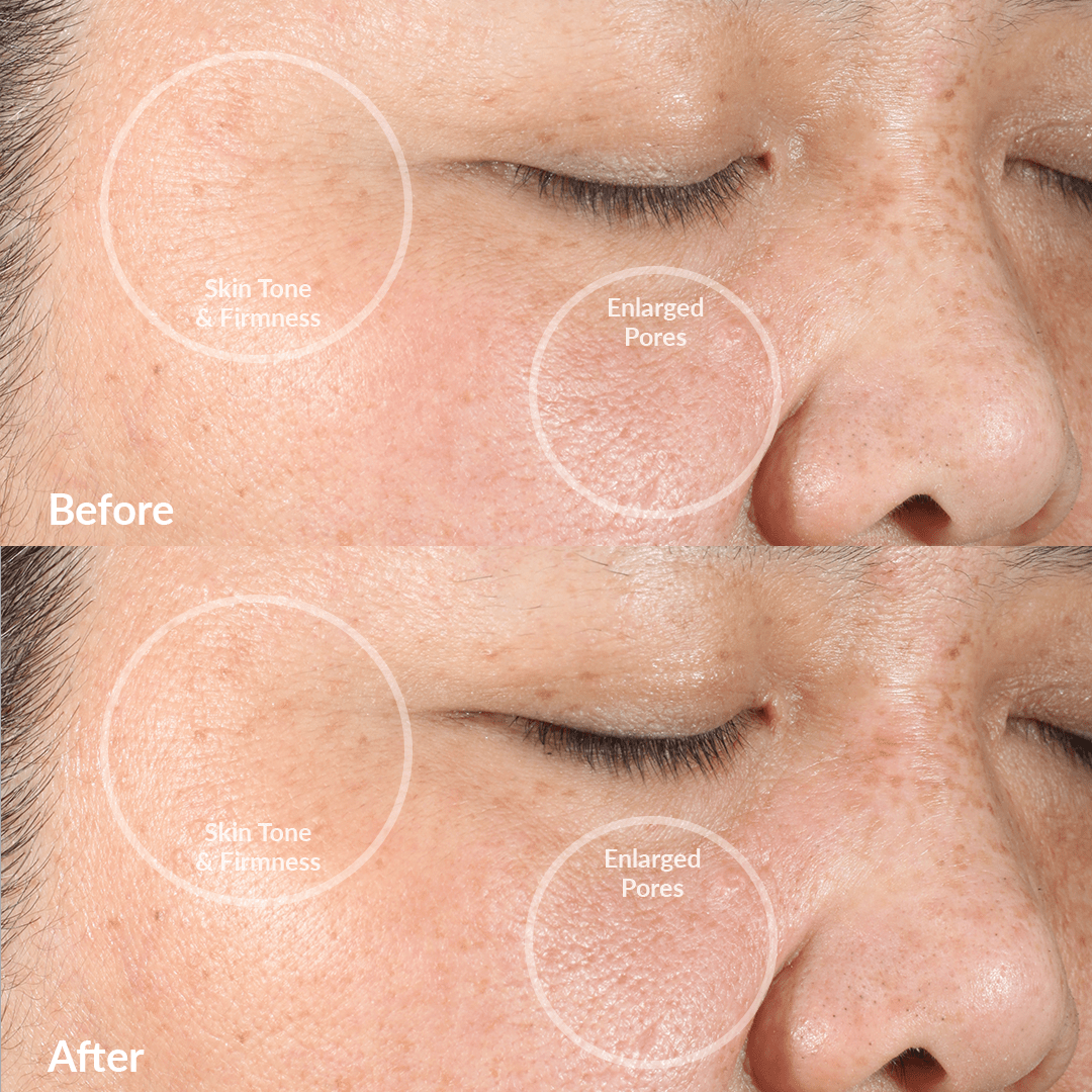 Diva - Dispositivo de limpieza facial PMD Clean