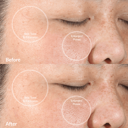 Diva - Dispositivo de limpieza facial PMD Clean