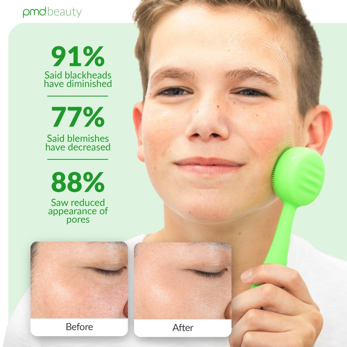 Diva - Dispositivo de limpieza facial PMD Clean